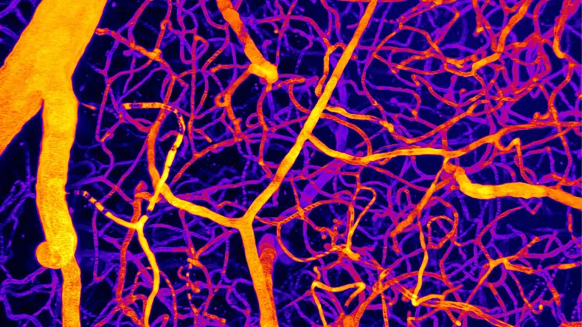 A Single Molecule May Explain How Blood Flow in The Brain Triggers Dementia : ScienceAlert