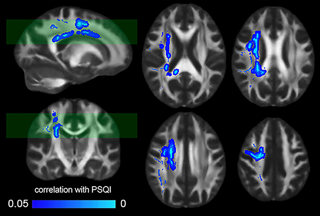 Brain scans