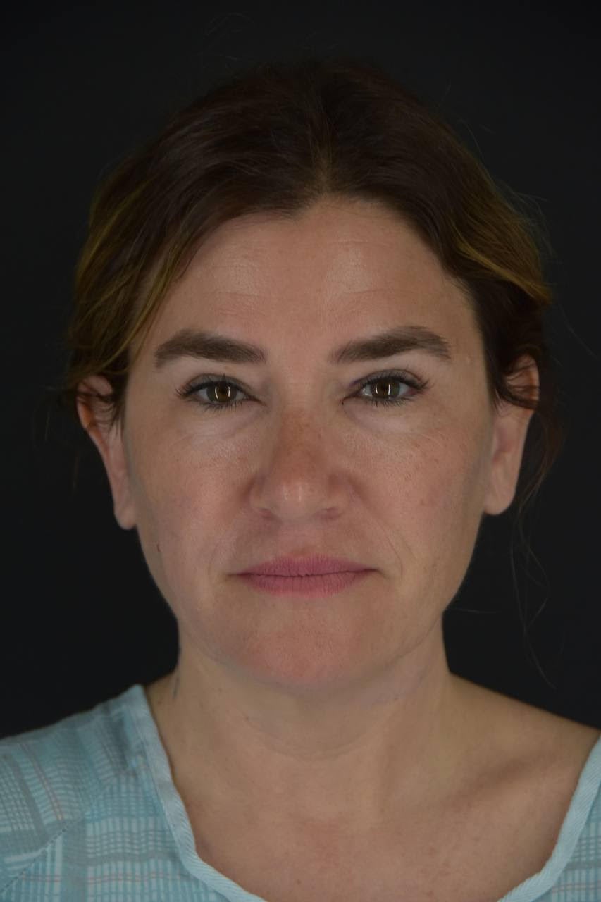 Dr. Sunder's patient Alli Webb