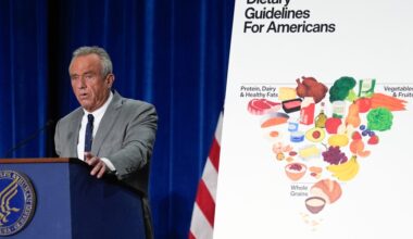 Down Arrow Button Icon