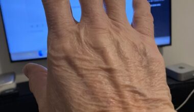 About the Aspirin Excuse