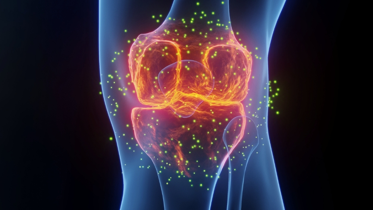 The Best Medicine For Joint Pain Isn't What You Think, Says Expert : ScienceAlert