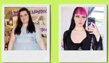 Losing 150 Pounds Didn’t End My Body Dysmorphia—Surgery Did