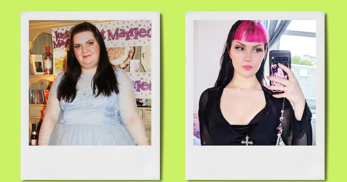 Losing 150 Pounds Didn’t End My Body Dysmorphia—Surgery Did