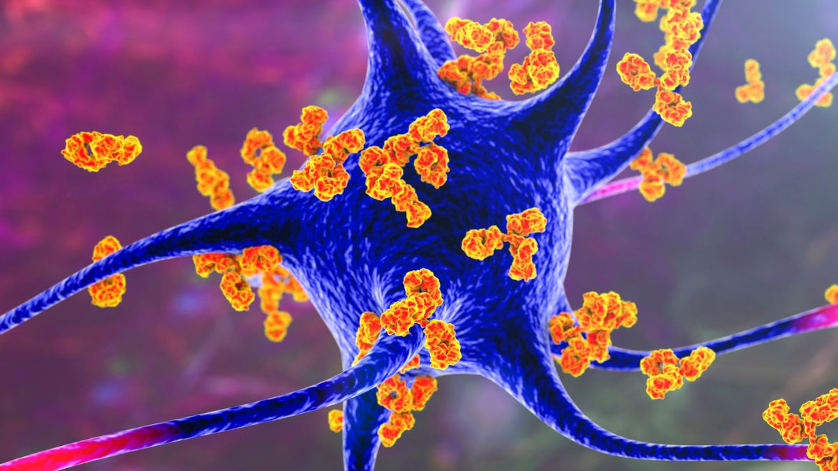 Forever Chemicals Linked to Multiple Sclerosis in Concerning New Study : ScienceAlert