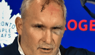 Leafs coach Craig Berube suffers large cut to head, bruised eye in gym accident