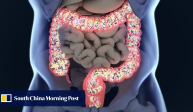 Why your gut microbiome is so important for health and how to protect it