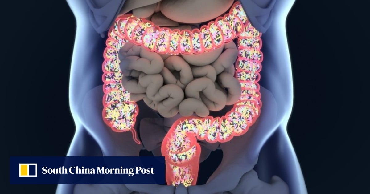 Why your gut microbiome is so important for health and how to protect it
