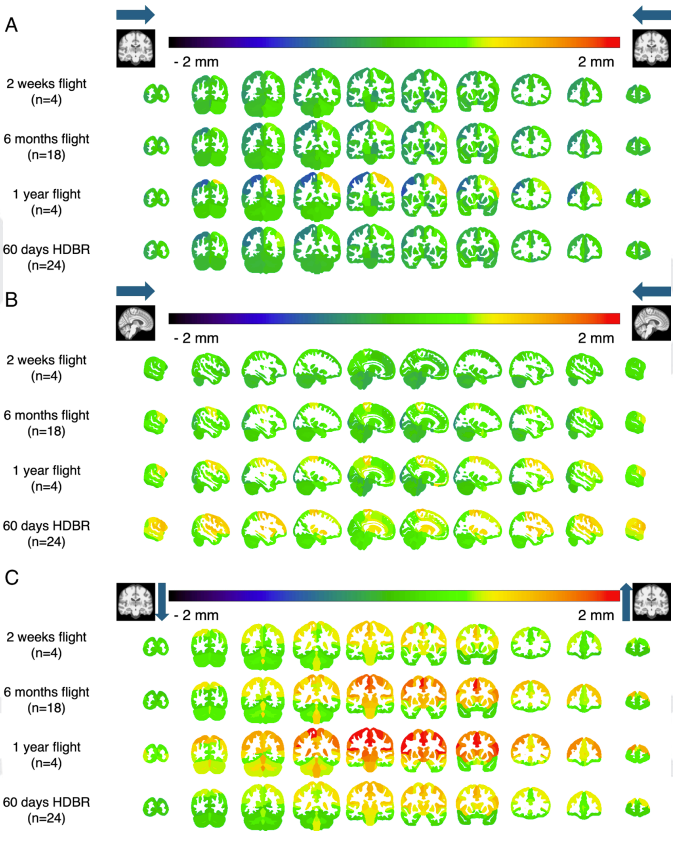 Rows of green and red brains line up with various colored bars showing movement