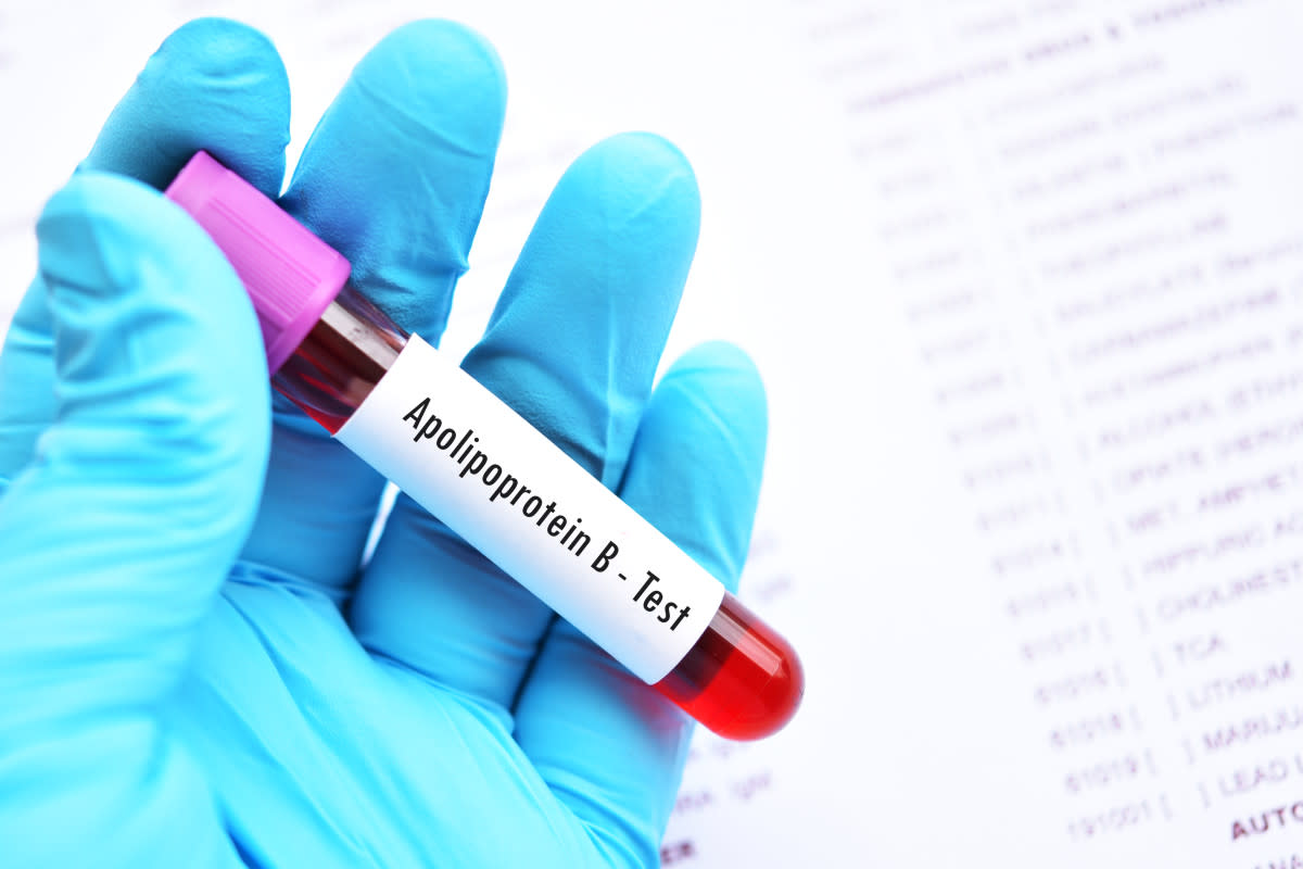 Blood sample tube for apolipoprotein B test&sol;Getty Image