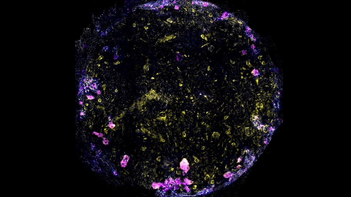 Scientists Made This Lung-on-a-Chip Breathe. Then They Gave It TB. : ScienceAlert