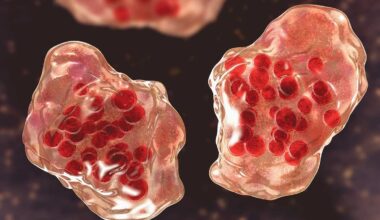 Person who traveled through Maryland had measles, MDH says