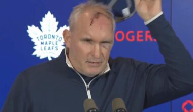 Maple Leafs' Craig Berube shows off terrifying cut after gym accident