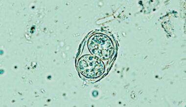 A Brain Parasite Infecting Millions Is Far Less Sleepy Than We Thought : ScienceAlert