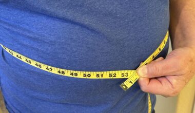 The share of Americans medically obese is projected to rise to almost 50% by 2035