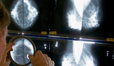 Cancer Patients Suffered a Pandemic Double Whammy