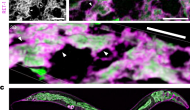ER remodelling is a feature of ageing and depends on ER-phagy
