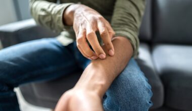 Sexually transmitted fungal infection outbreak hits Minnesota