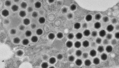 Researchers discover new giant 'ushikuvirus' in swamp near Tokyo