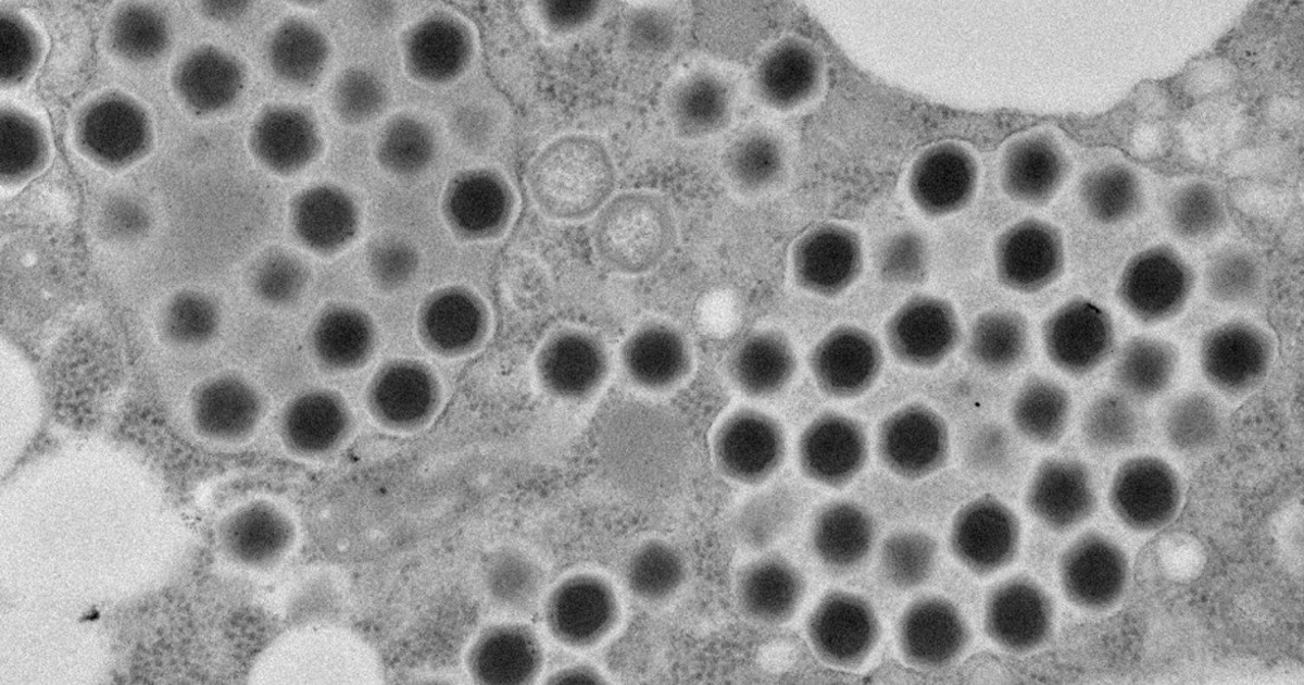 Researchers discover new giant 'ushikuvirus' in swamp near Tokyo