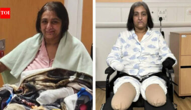 Indian-origin woman in England loses all four limbs after dog lick leads to sepsis: 'How did this happen in 24 hours?'