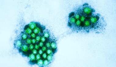 Norovirus outbreak forces North Texas middle school to shut down
