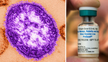 Potential measles exposure identified at several Wake County locations