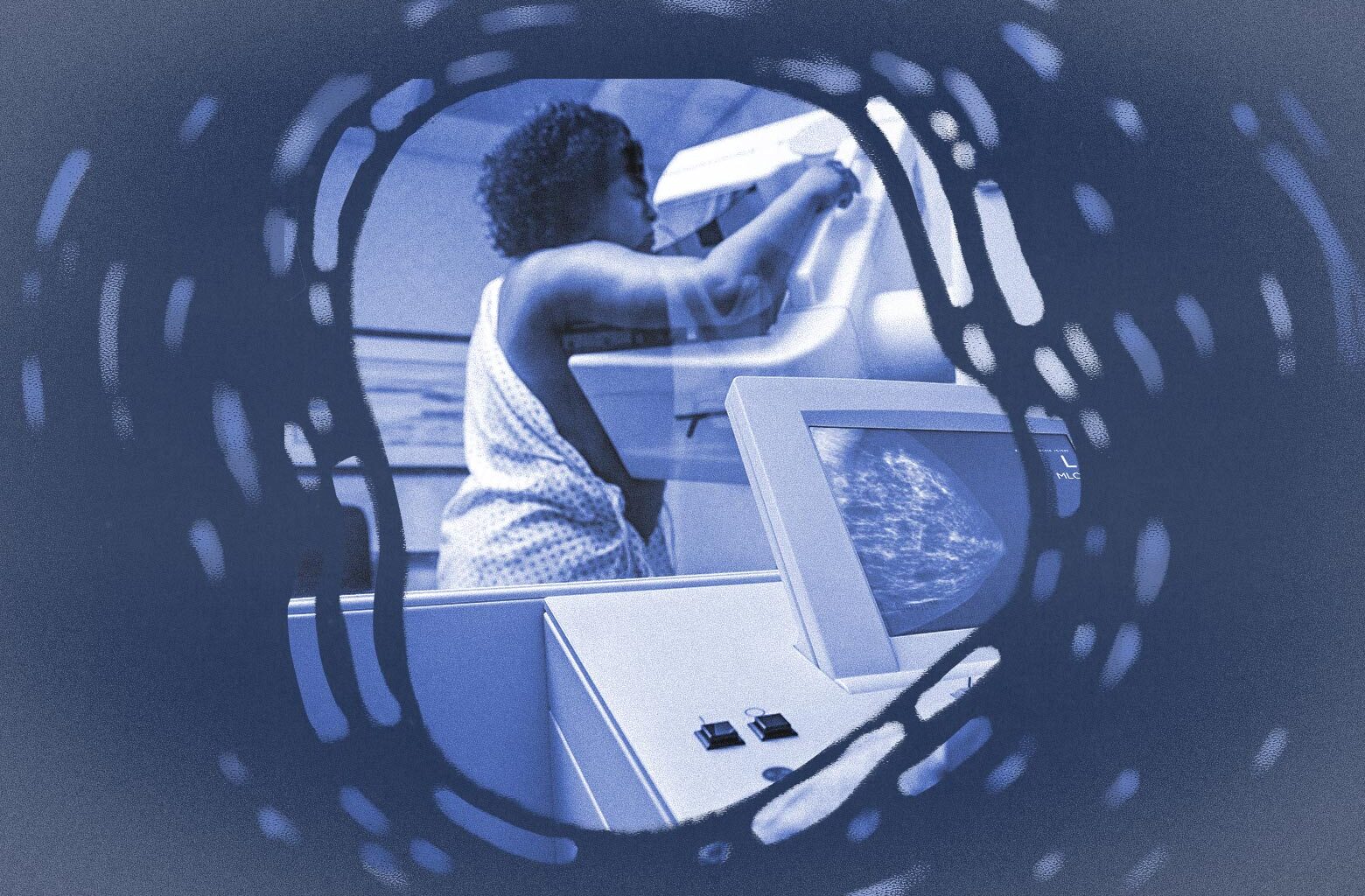 Breast cancer detection depends on mammograms. They don’t work for women like me.