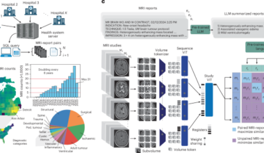 Learning neuroimaging models from health system-scale data