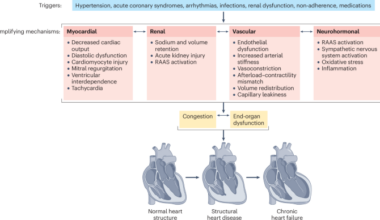 The environmental exposome in heart failure risk and progression