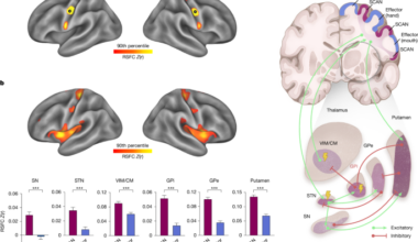 Parkinson’s disease as a somato-cognitive action network disorder