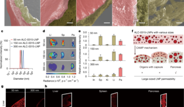 Pancreatic-targeted lipid nanoparticles based on organ capsule filtration