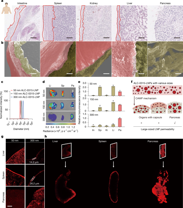 Pancreatic-targeted lipid nanoparticles based on organ capsule filtration