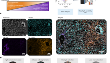 Single-cell spatial proteomics maps human liver zonation patterns and their vulnerability to disruption in tissue architecture
