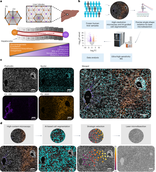 Single-cell spatial proteomics maps human liver zonation patterns and their vulnerability to disruption in tissue architecture