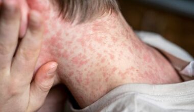 The Jerusalem Post - Israel News