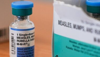 Measles case confirmed in UW-Madison student | News