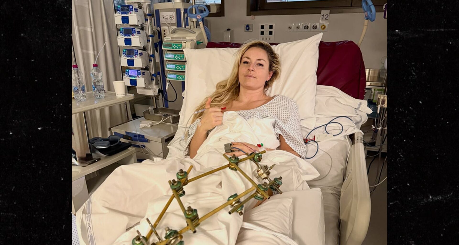Lindsey Vonn Has 'Successful' 3rd Surgery On Broken Leg, Posts Pic From Hospital Bed