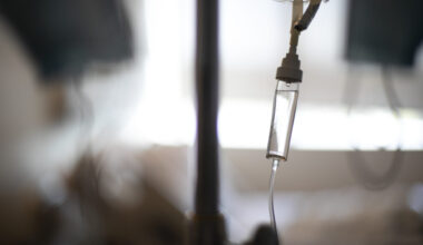 Study on timing cancer treatments to the morning comes under fire