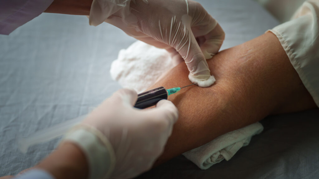 As telehealth firms market multi-cancer tests, doctors are wary