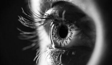 Ocular Therapeutix wet AMD drug Axpaxli tops Eylea in study