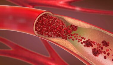 'Remnant' Cholesterol Cut by More Than 60 Percent in New Drug Trial : ScienceAlert