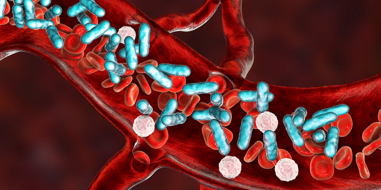A 3D illustration of sepsis, showing rod-shaped bacteria with red and white blood cells.