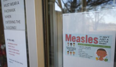 Adult with measles visited grocery stores, restaurant, animal shelter in Northern Virginia