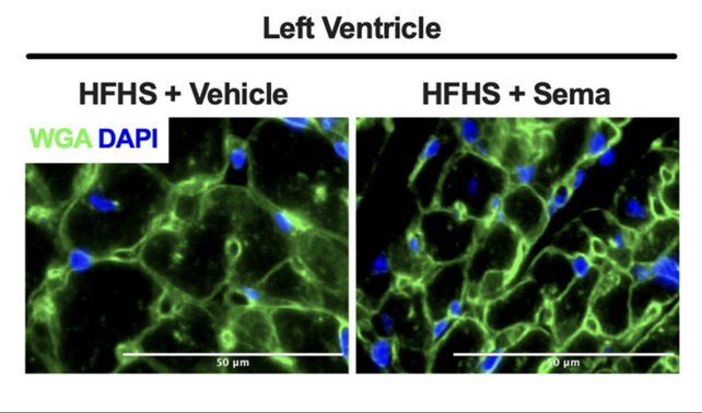 Mouse cardiac muscle comparing with and without semaglutide