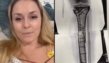 Lindsey Vonn’s ‘car crash’ injury explained: How long could her recovery take and will she ski again?