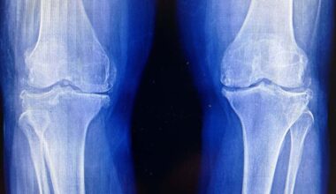 Scientists Found a Way to Regrow Cartilage Without Using Stem Cells