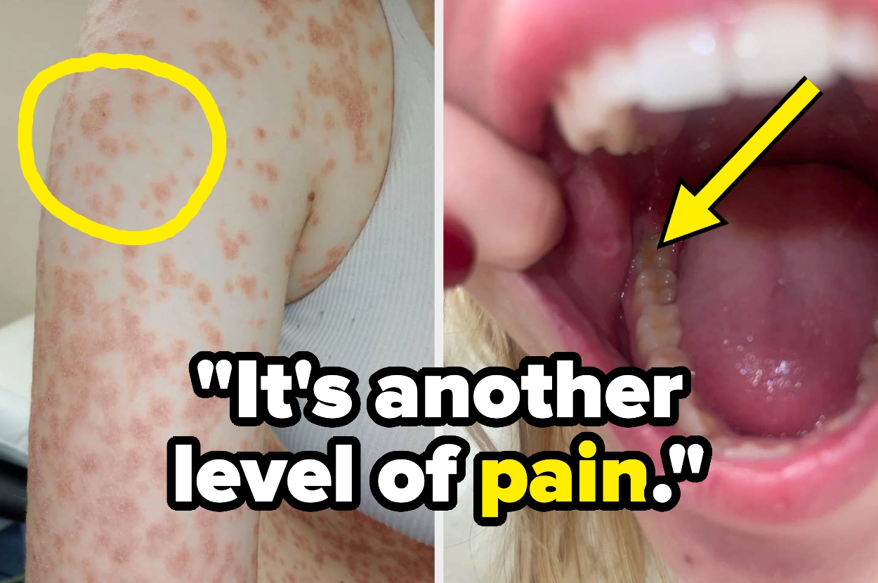 21 Hard Truths About Living With "Minor" Medical Issues