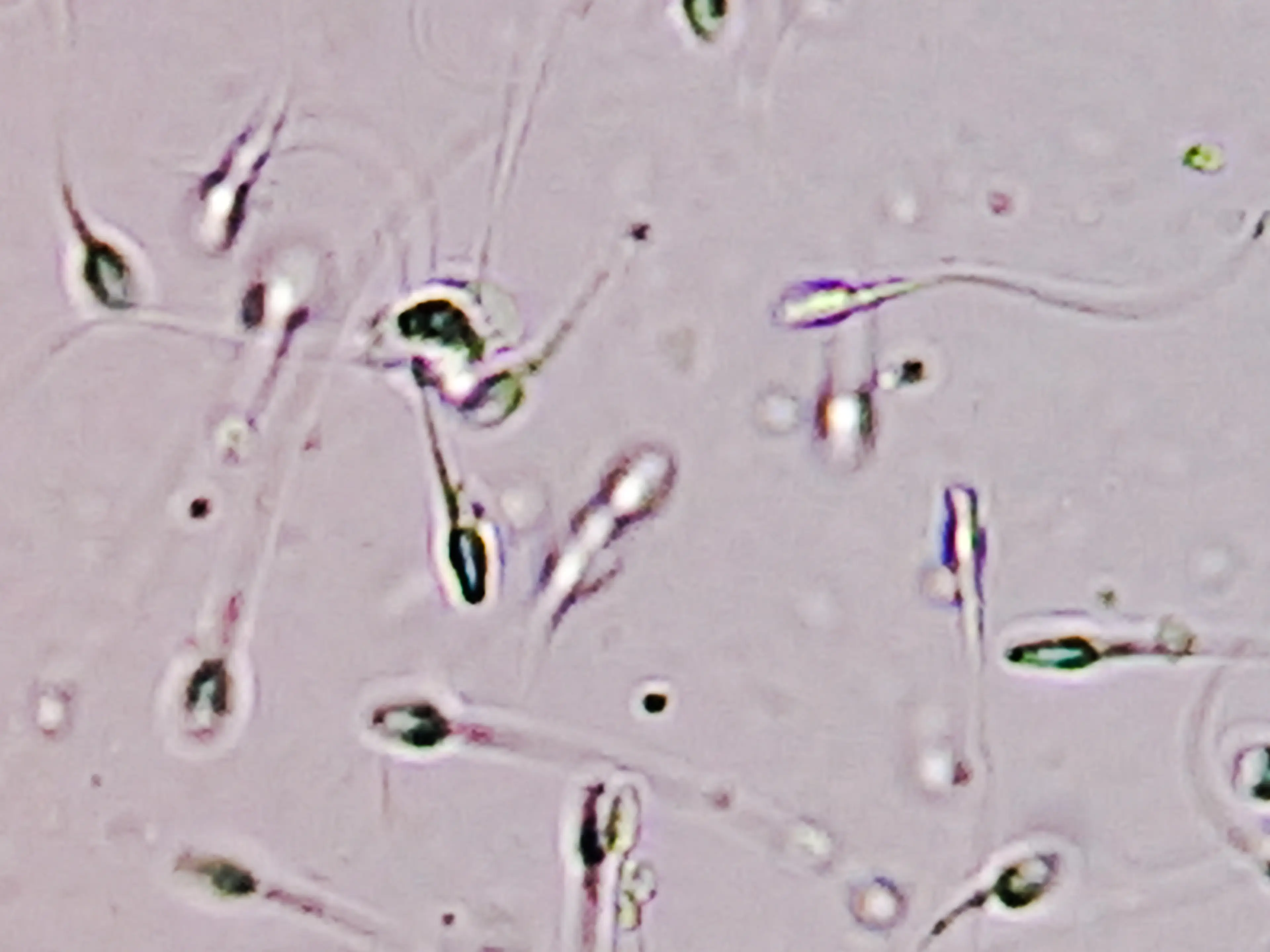 Ever wondered what happens when you swallow some of these bad boys? (Getty Stock Images)