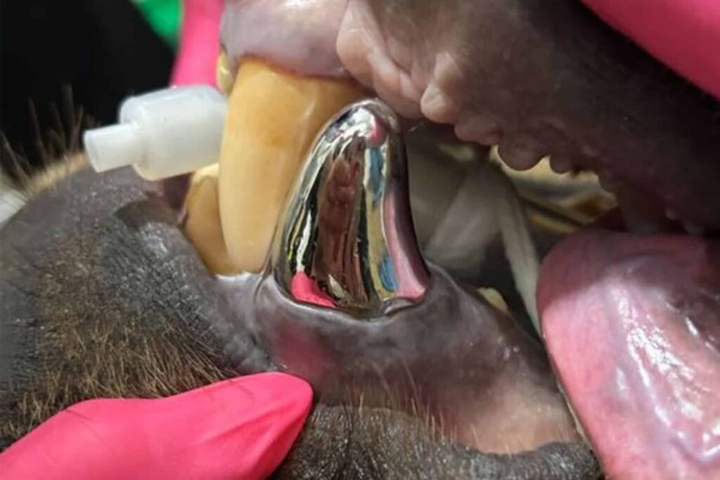 A dental procedure involving a metallic dental crown or implant in a patient's mouth.